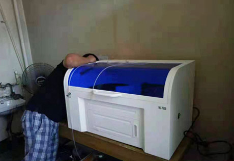 全自动tct细胞学检测仪宫颈癌症状